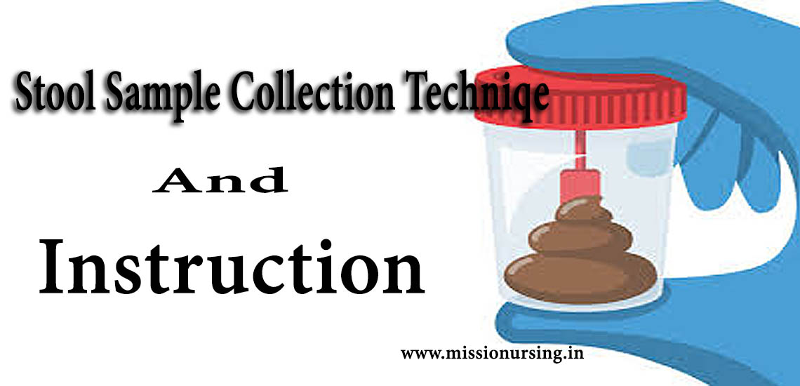 Stool Sample Collection Technique and Instruction