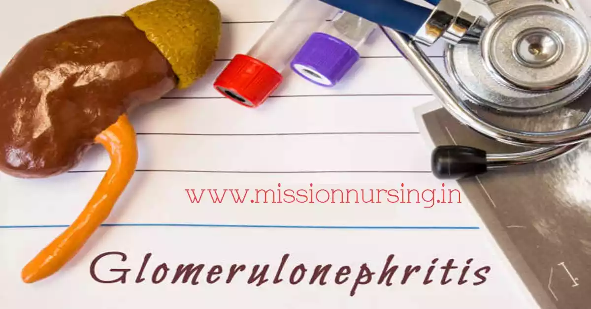 A glomerulonephritis is a group of kidney disorders