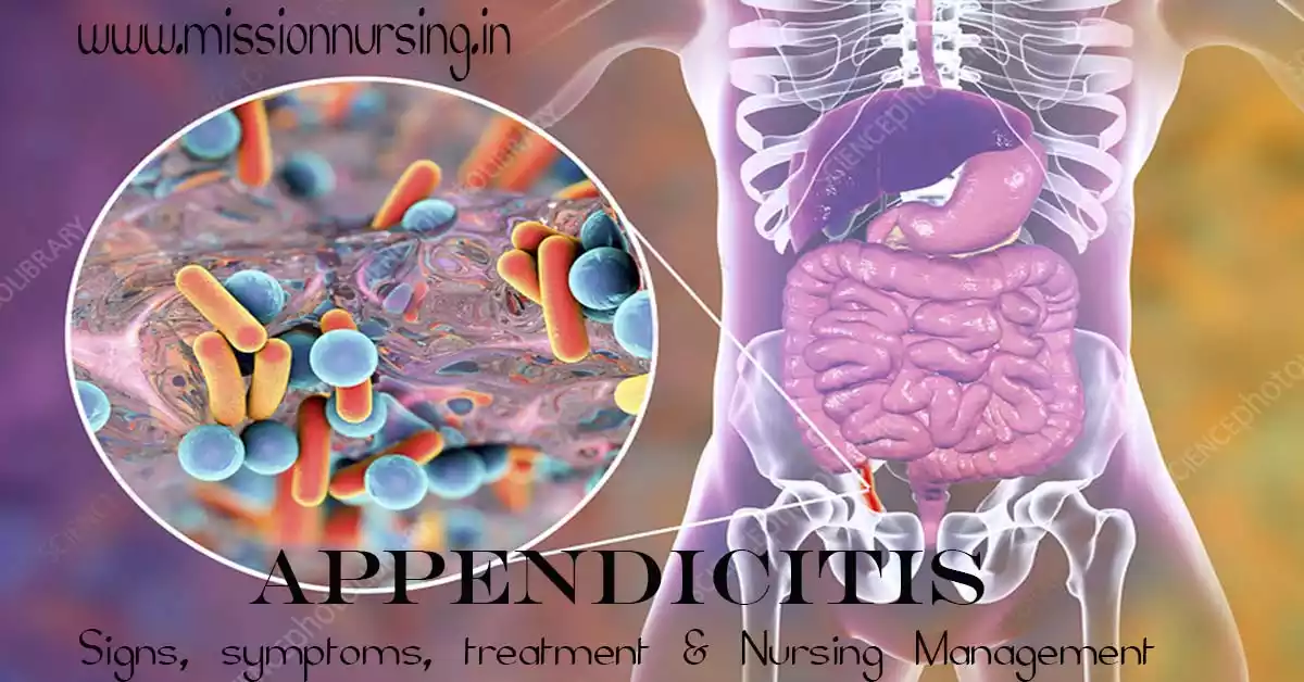Appendicitis Signs, symptoms, treatment & Nursing Management