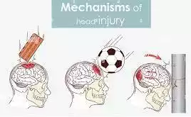 head injury pictures
